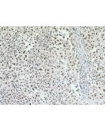 PSME3 Monoclonal antibody 67629-1-Ig proteintech