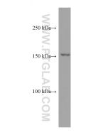 CPS1 Monoclonal antibody, PBS Only 67630-1-PBS proteintech