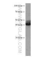 Nectin-4/PVRL4 Monoclonal antibody 67721-1-Ig proteintech