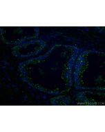 CTPS2 Monoclonal antibody, PBS Only (Capture) 67734-1-PBS proteintech