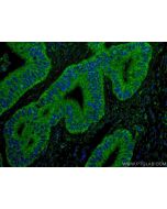 ING4 Monoclonal antibody, PBS Only 67754-1-PBS proteintech