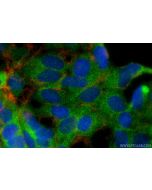 PSMD2 Monoclonal antibody 67770-1-Ig proteintech