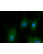 RCHY1 Monoclonal antibody, PBS Only 67856-1-PBS proteintech