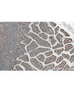LPCAT3 Monoclonal antibody 67882-1-Ig proteintech