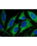 SCAMP3 Monoclonal antibody 67932-1-Ig proteintech