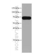 MFSD2 Monoclonal antibody 67965-1-Ig proteintech