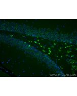 GDAP1 Monoclonal antibody 68083-1-Ig proteintech