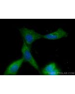 PPP1CC Monoclonal antibody, PBS Only 68122-1-PBS proteintech