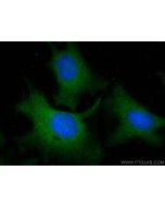 PLA2G4A Monoclonal antibody 68133-1-Ig proteintech