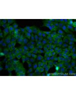 PSMB2 Monoclonal antibody 68180-1-Ig proteintech