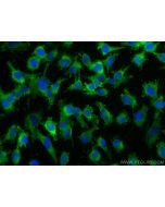 calcyphosine Monoclonal antibody, PBS Only 68225-1-PBS proteintech