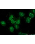CBX2 Monoclonal antibody, PBS Only 68244-1-PBS proteintech