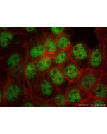 ZHX2 Monoclonal antibody 68268-1-Ig proteintech