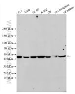 TGF Beta 1 Recombinant monoclonal antibody Proteintech  81746-2-RR