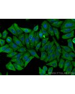 HERPUD2 Monoclonal antibody 68427-1-Ig proteintech