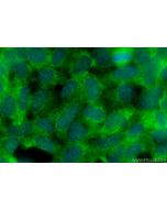 SKIV2L Monoclonal antibody, PBS Only 68547-1-PBS proteintech