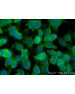 Spermidine synthase Monoclonal antibody 68548-1-Ig proteintech