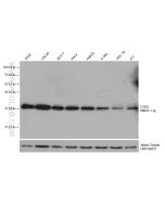 UCK2 Monoclonal antibody 68622-1-Ig proteintech
