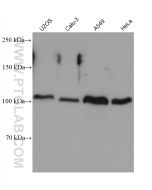 ADAM17 Monoclonal antibody, PBS Only (Detector) 68725-1-PBS proteintech