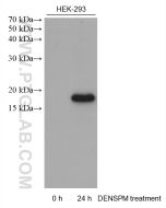 SAT1 Monoclonal antibody, PBS Only 68928-1-PBS proteintech