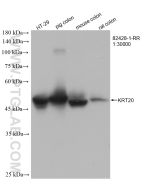 Cytokeratin 20 Recombinant monoclonal antibody Proteintech  82428-1-RR
