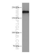 NF-H/NF200 Monoclonal antibody Proteintech  60331-1-Ig