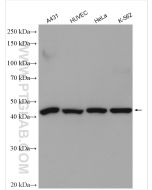RRM2 Polyclonal antibody Proteintech  11661-1-AP