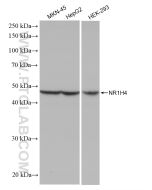 NR1H4 Recombinant monoclonal antibody Proteintech  81820-2-RR