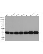 UCH-L1/PGP9.5 Polyclonal antibody Proteintech  14730-1-AP