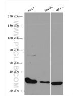 CDK4 Polyclonal antibody Proteintech  11026-1-AP