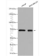 MMP-9 (N-terminal) Polyclonal antibody Proteintech  10375-2-AP