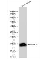 GLIPR1L1 Recombinant monoclonal antibody Proteintech  83584-3-RR