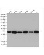 Annexin A1 Polyclonal antibody Proteintech  21990-1-AP