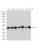 RFC2 Recombinant monoclonal antibody Proteintech  84892-1-RR