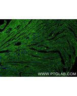 Cardiac Troponin T Recombinant monoclonal antibody, PBS Only 81638-3-PBS proteintech
