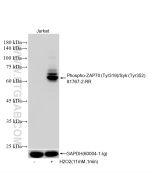 Phospho-ZAP70 (Tyr319)/SYK (Tyr352) Recombinant monoclonal antibody 81767-2-RR proteintech