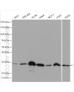 human BCL2 Polyclonal antibody Proteintech  12789-1-AP
