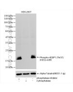 Phospho-4EBP1 (Thr37) Recombinant monoclonal antibody 81812-4-RR proteintech