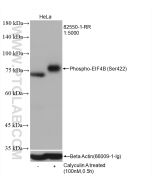 Phospho-EIF4B (Ser422) Recombinant monoclonal antibody 82550-1-RR proteintech