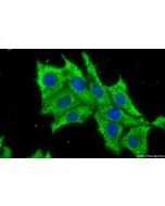 RAB31 Recombinant monoclonal antibody 83434-2-RR proteintech