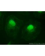 PI3 Kinase p85 Beta Recombinant monoclonal antibody, PBS Only 83606-5-PBS proteintech