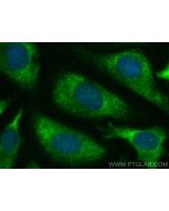 SRP19 Recombinant monoclonal antibody 84061-3-RR proteintech