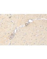 TRPM7 Recombinant monoclonal antibody 84324-1-RR proteintech