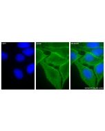 CD98/SLC3A2 Recombinant monoclonal antibody 84387-6-RR proteintech