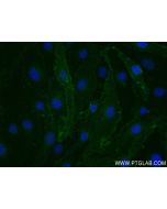 Mouse Tie-2/CD202b Recombinant monoclonal antibody, PBS Only 84469-5-PBS proteintech