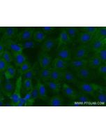 ADAMTS2 Recombinant monoclonal antibody, PBS Only 84476-6-PBS proteintech