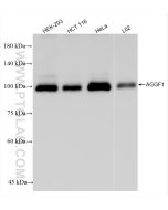 AGGF1 Recombinant monoclonal antibody, PBS Only 84715-3-PBS proteintech