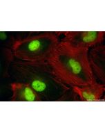 MPP8 Recombinant monoclonal antibody 84719-4-RR proteintech