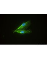 ICAM-2/CD102 Recombinant monoclonal antibody 84857-2-RR proteintech