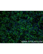 Mouse TCB1 Recombinant monoclonal antibody, PBS Only 84878-5-PBS proteintech